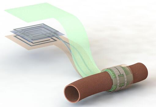 上圖描繪了這款可生物降解的壓力傳感器，它圍繞著一根血管，天線在左側(cè)(分離的層狀結(jié)構(gòu)，展示了天線結(jié)構(gòu)的細(xì)節(jié))
